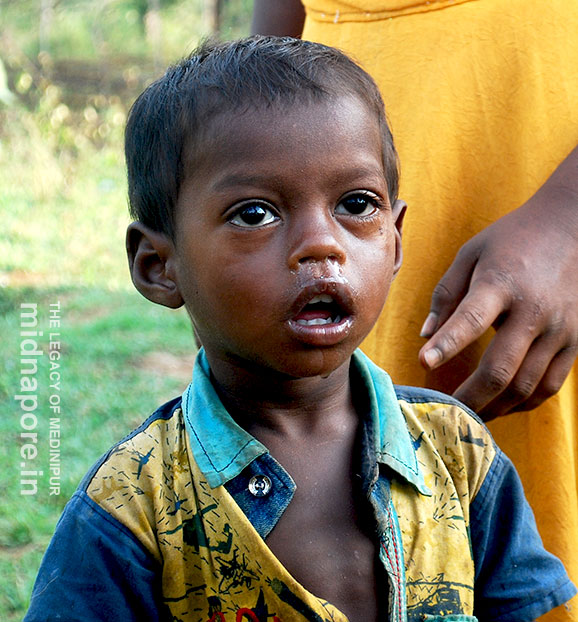 COVID-19 (CoronaVirus) Updates of Jhargram, Purba Medinipur and Paschim Medinipur
